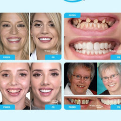 SMILEFIT PRO – NASTAVITELNÁ ZUBNÍ SADA PRO DOKONALÝ ÚSMĚV